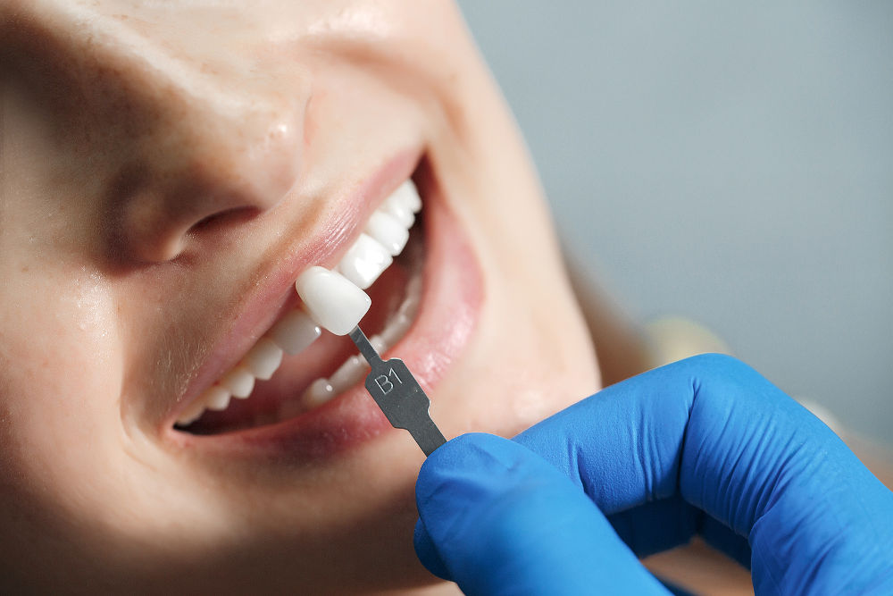 Dentalna hygiena